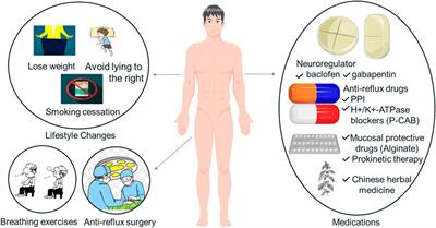 GERD-related chronic cough: Possible mechanism, diagnosis and treatment